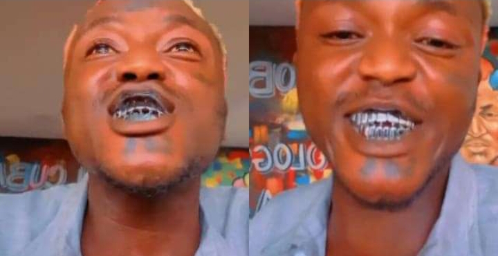 My N420,000 teeth wants to kill me – Portable unable to speak properly days after fixing grills [Video]